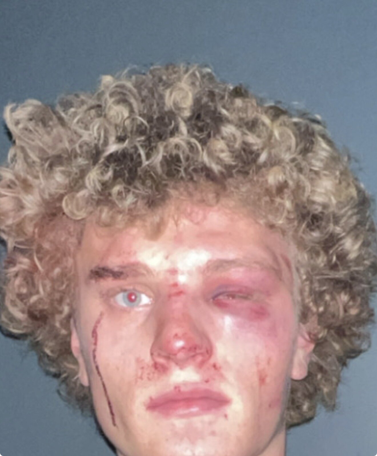 XXX Porn Photo of Nude PAPITRVN 4