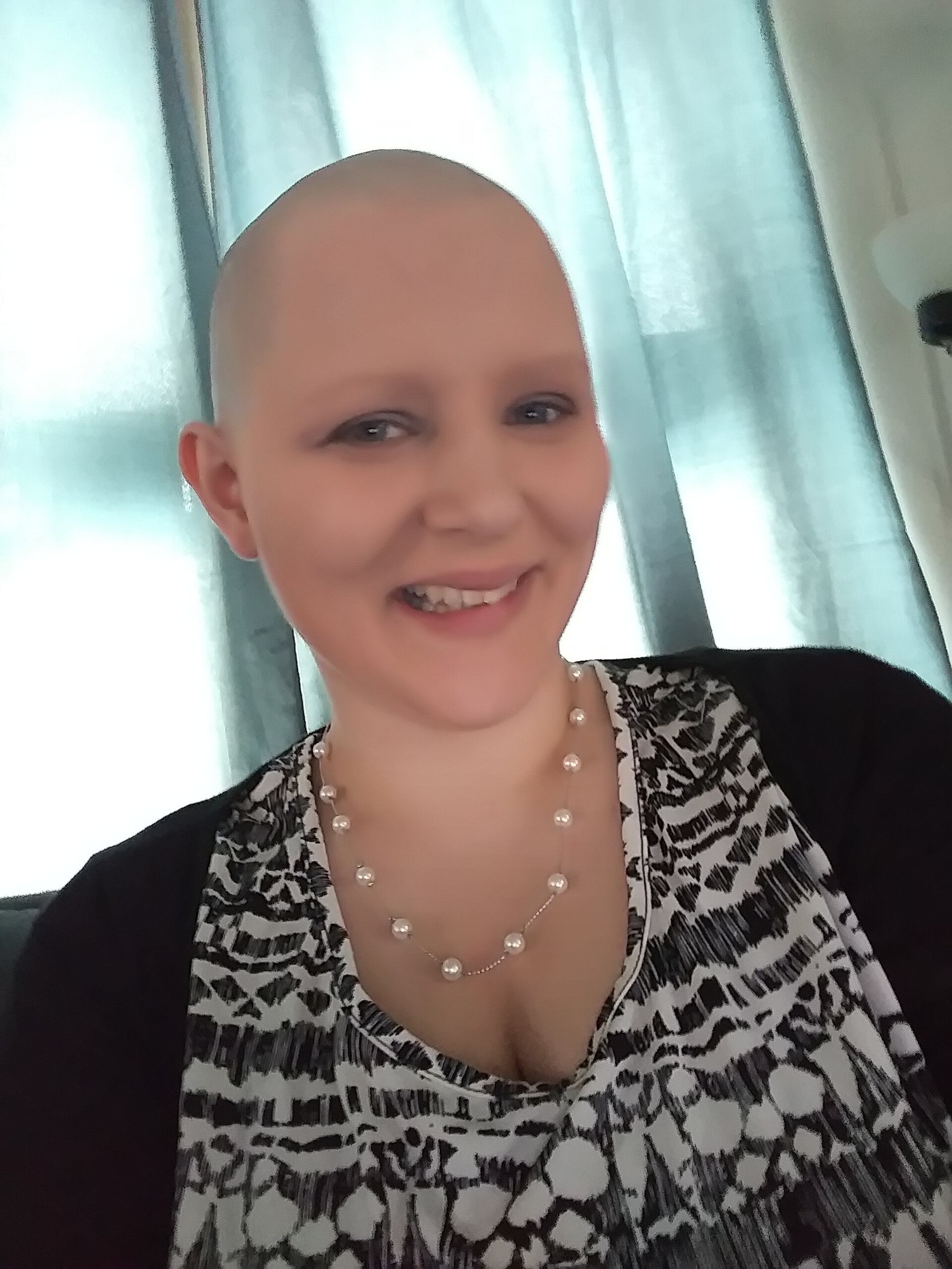 XXX Porn Photo of Nude Baldbabey 7